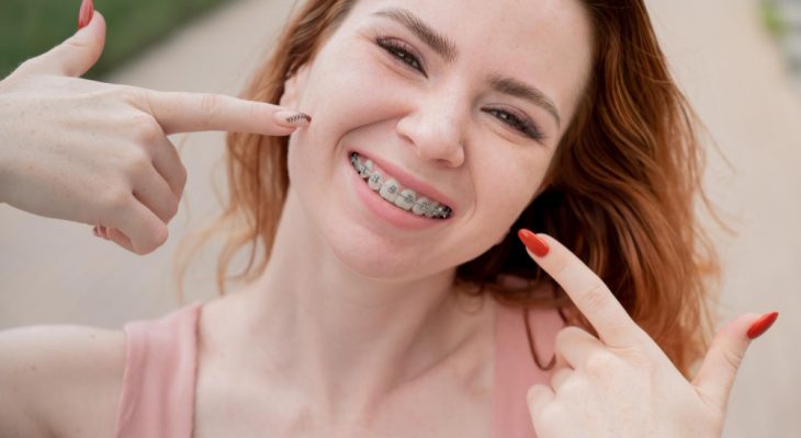 Pași esențiali după îndepărtarea aparatului dentar