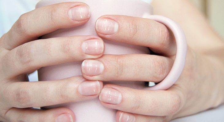 Petele albe pe unghii: Cauze și soluții eficiente